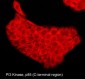 Anti-PI3 Kinase, p85 (C-terminal region) Antibody